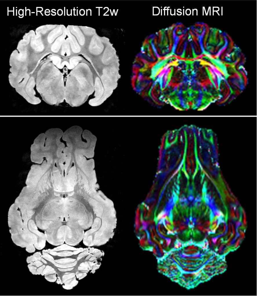 High-resolution brain MRI of Yorkshire piglet model of congenital heart disease.