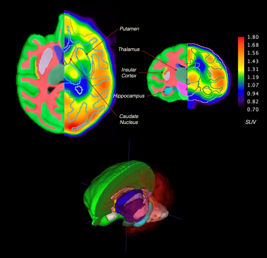 Baboon brain atlas in (A) Axial (B) Coronal and (C) 3D View.