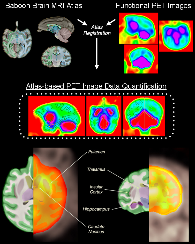 Pipeline for high-throughput MRI-PET image analysis.