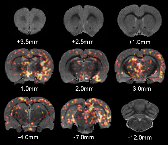 Significance maps of the DTI-FA in rat brain